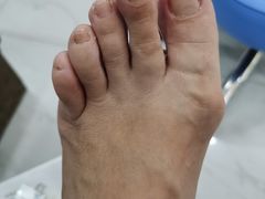 -Andrew指甲专科灰指甲·甲沟炎矫正·3D步态矫形鞋垫定制(浦三路店)