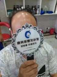 -唐风采假发补发定制