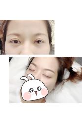 -MIVI半永久纹眉绣眉
