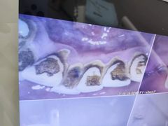-同步齿科·数字化正畸种植口腔中心(前山店)