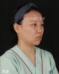 -北京米扬丽格医疗美容·联合丽格鼻整形中心