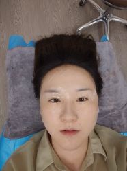 体验后-兰州华美整形美容医院