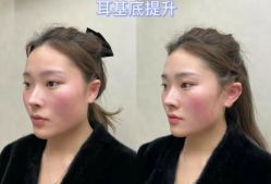 点击看大图 -Yestar艺星医疗美容医院