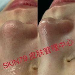 -skin79皮肤管理中心