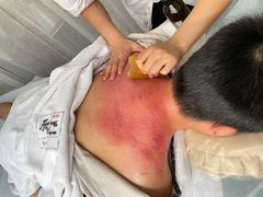 -承启堂中医馆·推拿·针灸(成华馆)