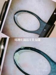 点击看大图 -凡碧诗毛孔收细