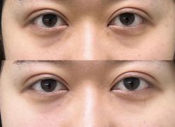 -CMS西美斯·美式医疗美容