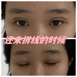 -素美医疗美容·西南眼鼻整形·修复基地