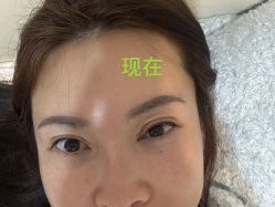 -广州美莱医疗美容医院