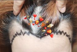 -大麦微针植发全国连锁