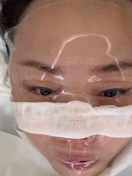 体验后-Dr.U博士医疗美容医院