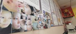 -北京美痣堂古方祛痣斑疣瘊