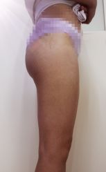 -成都西区医院整形美容