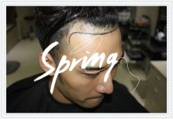 -大麦微针植发全国连锁