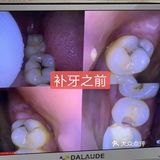 儿童牙科知识必知