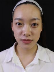 体验前-Yestar重庆艺星医疗美容医院