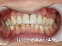 -团圆口腔·种植中心(锦江院区)