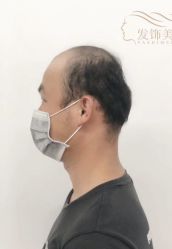 -发饰美男士增发补发假发定制店