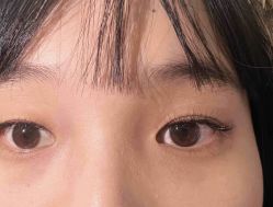 -木锦-科技美肤