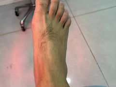 -世龙世家甲沟炎·灰指甲·嵌甲矫正·修脚(武侯区双楠店)