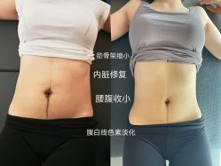 -无界瑜伽普拉提