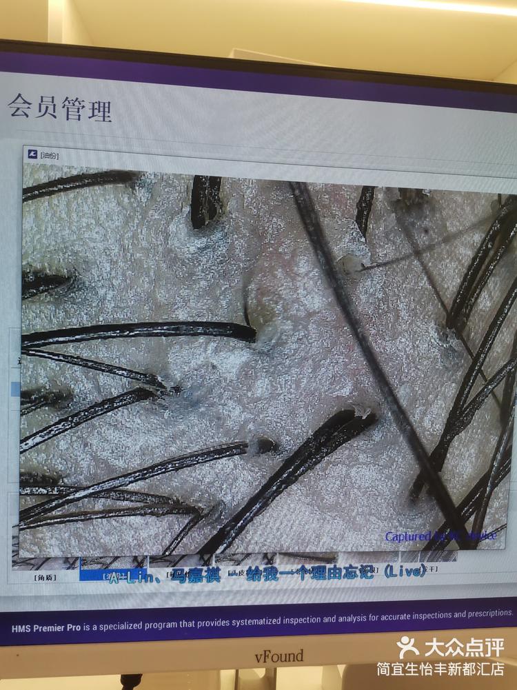 头皮卸妆前后对比