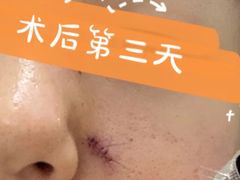 -上海市第一人民医院(松江南部)