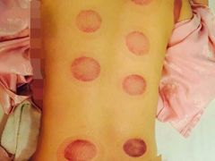 -莱蔻·圣灸堂·推拿艾灸(天山店)