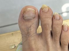 -世龙世家甲沟炎·灰指甲·嵌甲矫正·修脚(武侯区双楠店)