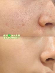-凡碧诗毛孔清洁收细