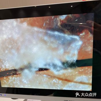 为什么要进行头皮排毒呢?	  	1