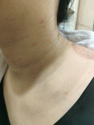 -北京美痣堂古方祛痣斑疣瘊