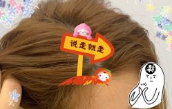 -大麦微针植发全国连锁