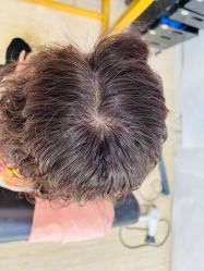 -髻尚坊增发补发织发假发定制