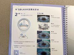 -黑马眼科·近视手术