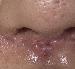 -成都军建医院·疤痕诊疗中心