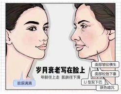 -苗方清颜专业祛痘连锁机构