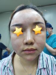 -洁铭新加坡医美