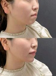 -郡艺医疗美容·微整·眼鼻吸脂