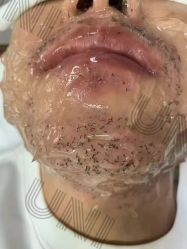 -ANRI安里·专业男士脱毛连锁