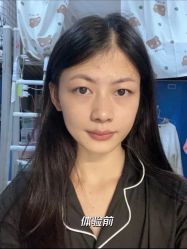 -广东韩妃整形外科医院