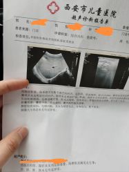 -西安市儿童医院(西门院区)