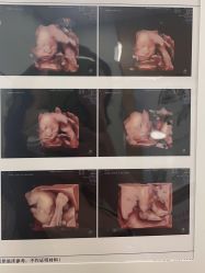 -杭州贝瑞斯美华妇儿医院·早孕·产检·儿科