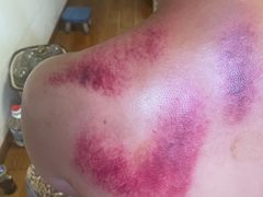 -沈师傅盲人按摩工作室(密三小区店)