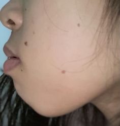 点击看大图 体验前-广州美莱医疗美容医院