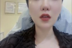 体验后-上海首尔丽格医疗美容医院