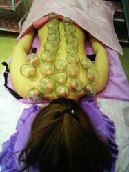 android_upload_pic-悦艾堂·中医拔罐减肥·美体艾灸连锁