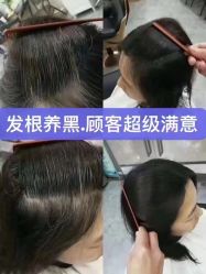 -希梵尔头皮抗衰·科技养发