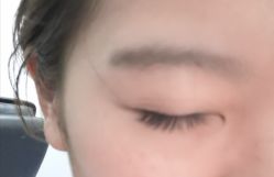 -初樱科技美学问题肌修复中心