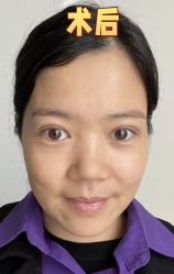 -素美医疗美容·西南眼鼻整形·修复基地